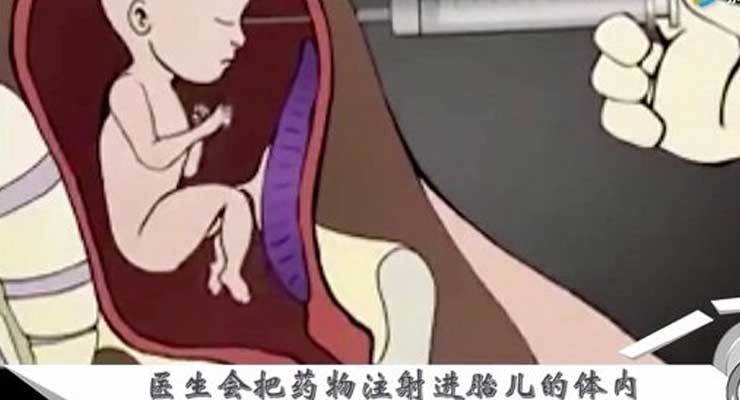 哪些因素会导致试管婴儿畸形？怎样才能预防它们？