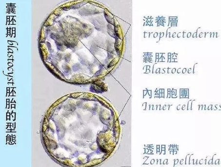 试管婴儿胚胎等级