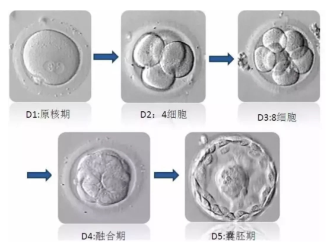 试管婴儿胚胎等级