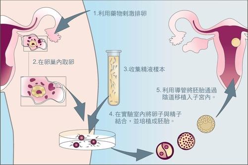 武汉双胞胎助孕产子机构-坏习惯会让你在不知不觉中不孕不育~怀孕。