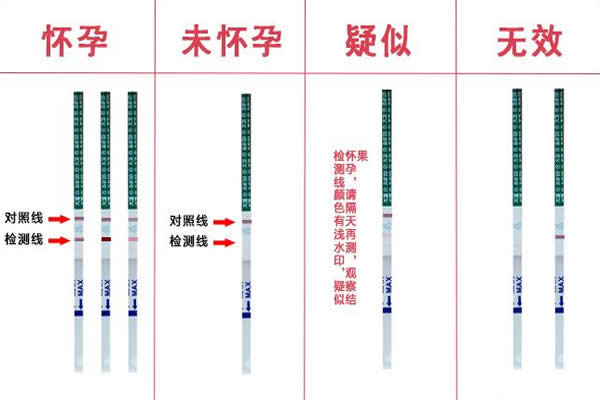 济南孕检哪家医院好